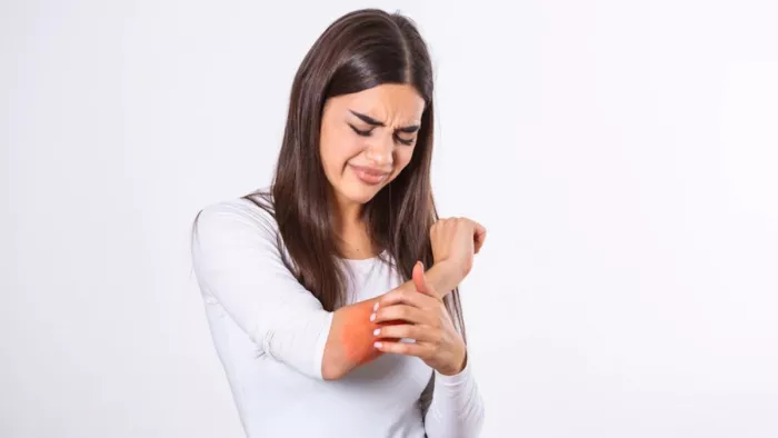 Winter Rashes: सर्दियों में खुजली से हैं परेशान, तो राहत पाने के लिए ...