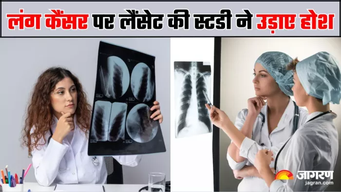 Lung Cancer Risk: सिर्फ स्मोकर्स ही नहीं, इन लोगों को भी रहता है लंग कैंसर का खतरा (Image Source: Freepik)