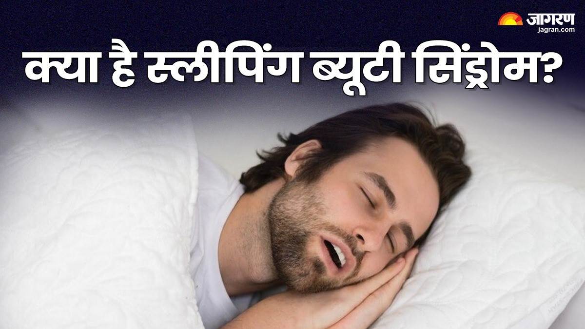 https://www.jagranimages.com/images/newimg/04022025/04_02_2025-sleeping_beauty_syndrome_23878616.jpg