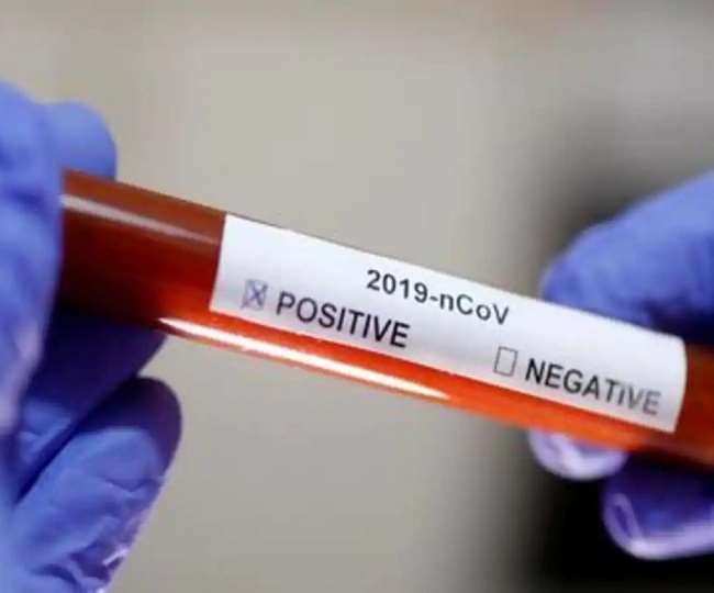 CoronaVirus Positive in UP : उत्तर प्रदेश में अब तक मिले 249 संक्रमितों में तब्लीगी जमात के 101 लोग