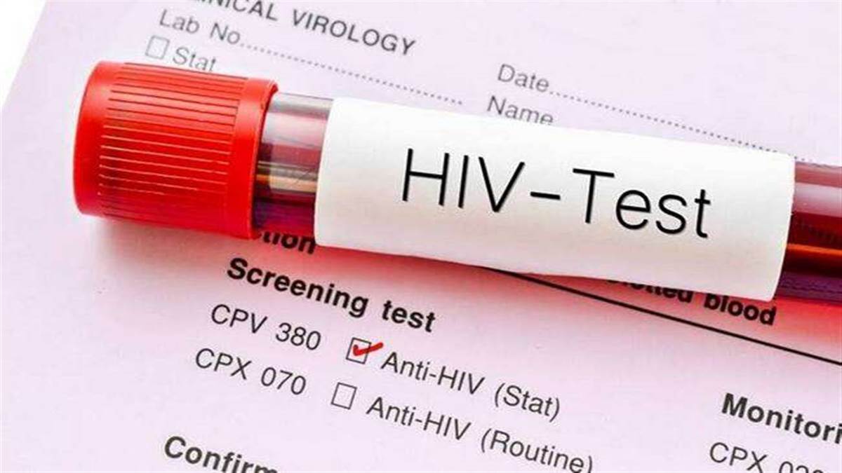 चार दिन पहले हुए एचआइवी संक्रमण का भी चलेगा पता, लखनऊ के लोहिया संस्थान में मशीन लगी HIV and