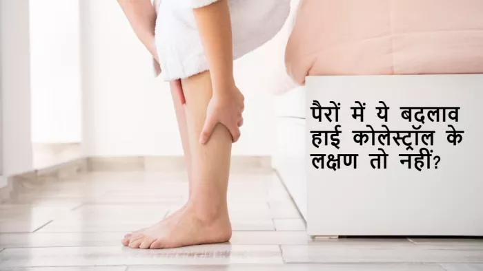 कहीं हाई कोलेस्ट्रॉल की तरफ तो इशारा नहीं कर रहे ये लक्षण