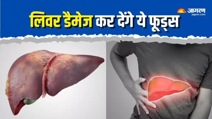 Fatty Liver: इन 3 चीजों को खाने से बढ़ जाता है फैटी लिवर का रिस्क (Picture Courtesy: Freepik)