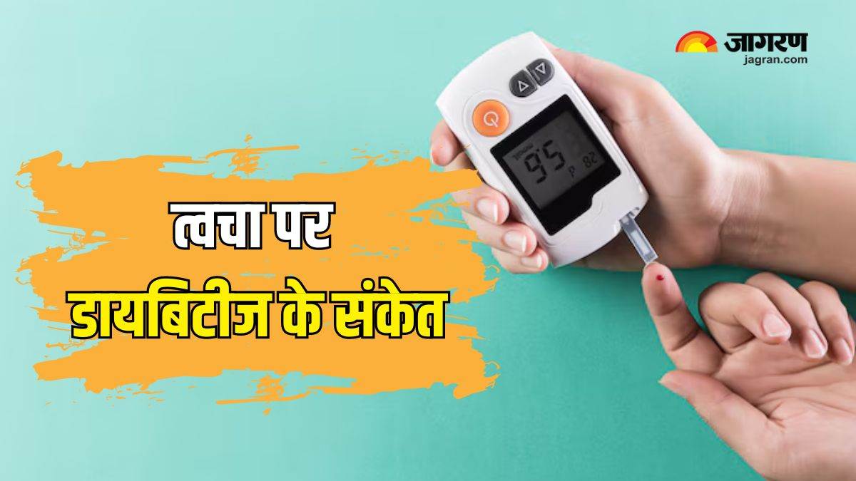 https://www.jagranimages.com/images/newimg/04072024/04_07_2024-diabetes_signs_on_skin_23752316.jpg