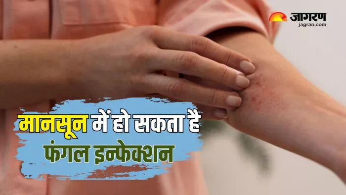 ऐसे करें Fungal Infection से बचाव (Picture Courtesy: Freepik)