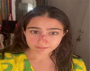 सबा अली खान ने भतीजी की चोट पर अपडेट दिया हैl