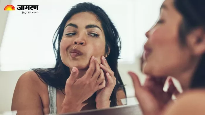 Damage Skin के पीछे स्ट्रेस का भी हो सकता है बड़ा हाथ (Image Source: Freepik)