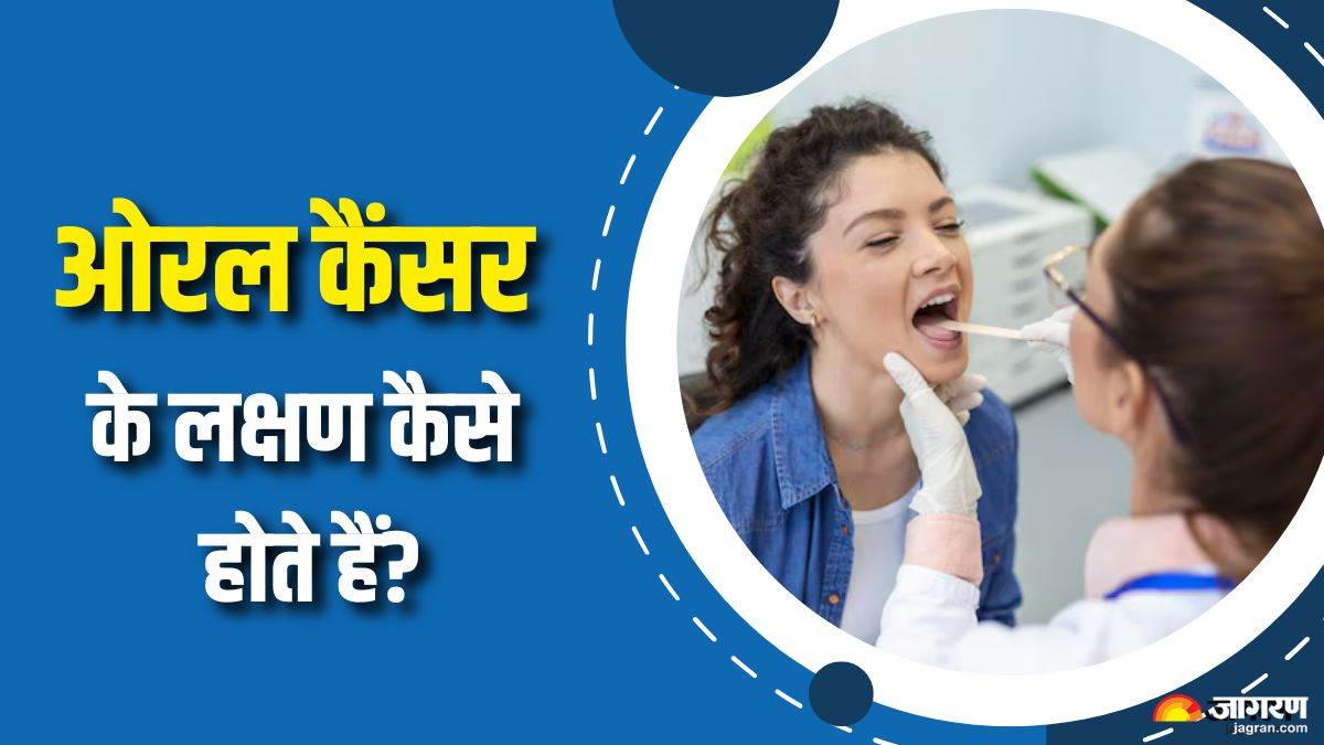 https://www.jagranimages.com/images/newimg/04092025/04_09_2025-oral_cancer_warning_signs_24035066.jpg