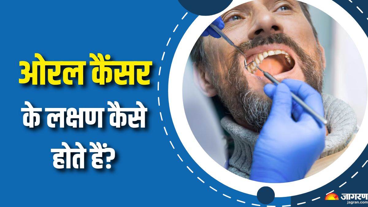 https://www.jagranimages.com/images/newimg/04092025/04_09_2025-oral_cancer_warning_signs_24035066_114846671.jpg