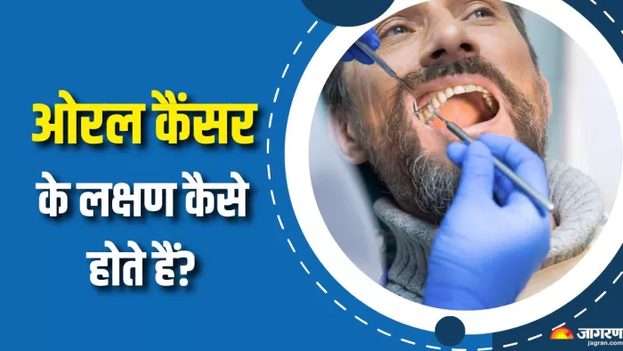 कैसे करें ओरल कैंसर की पहचान? (Picture Courtesy: Freepik)