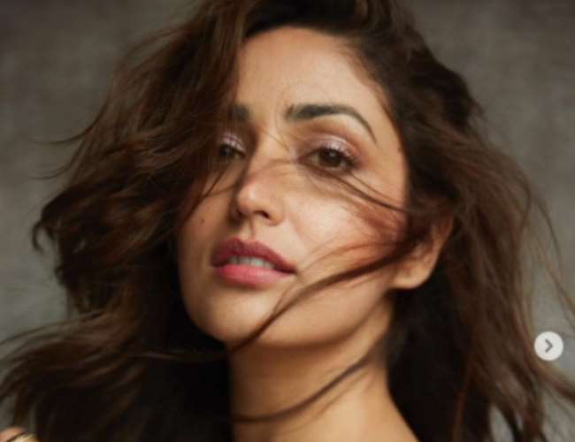 Yami Gautam opens on her skin condition. Photo- Instagram