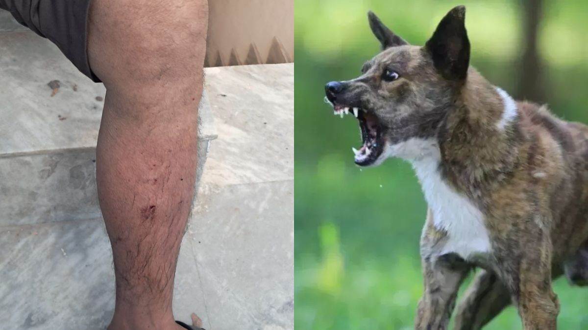 ncr elderly man attacked by stray dogs during morning walk
