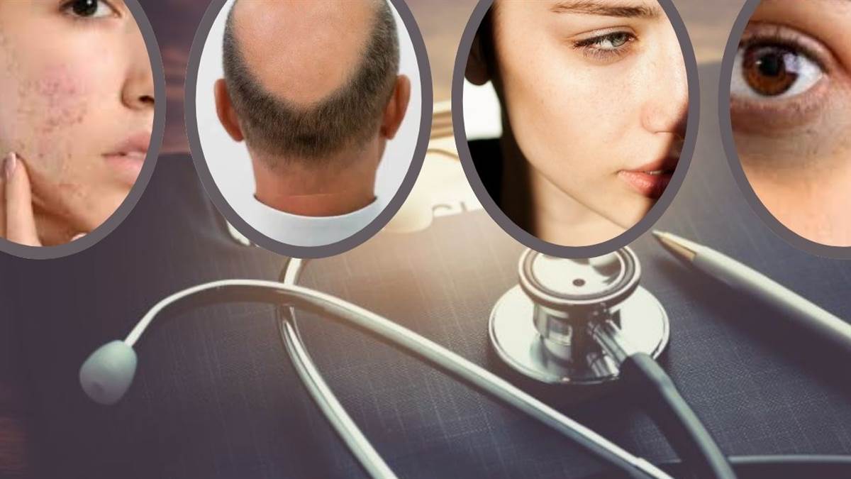 hair loss dark spots caused by hormonal changes know advice of kanpur senior dermatologist