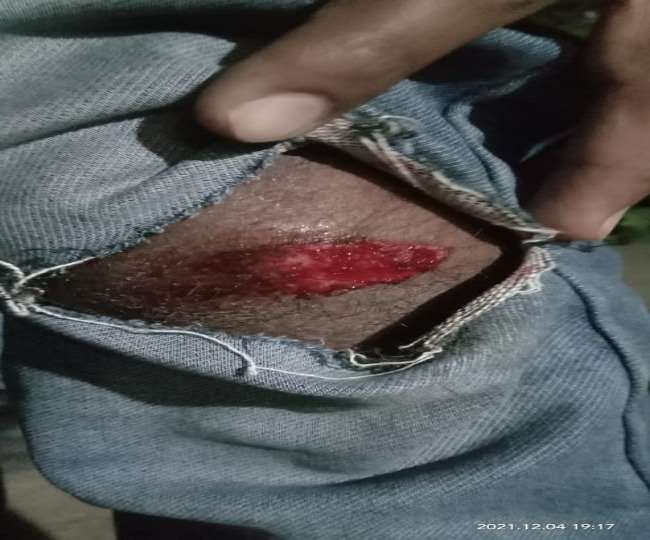 1090 चौराहे पर कैंडिल मार्च निकालने जा रहे थे, जहां पुलिस ने उनकी लाठी, डंडों से बेरहम पिटाई कर दी।