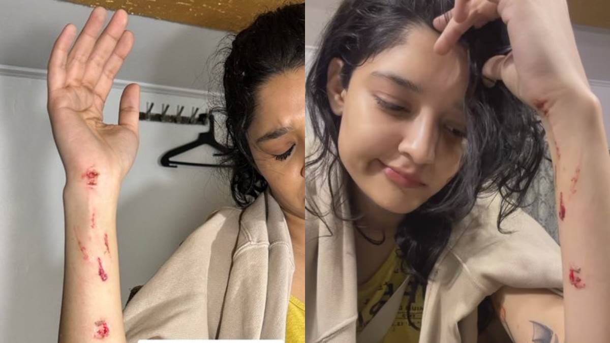 rajinikanth actress ritika singh got badly injured during the shooting