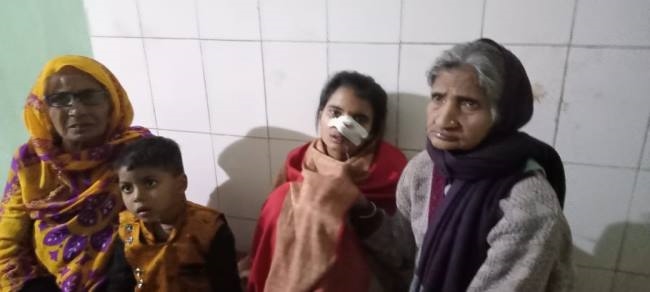 drunk soldier chewed on wifes nose