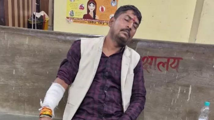 हमले में घायल भाजपा समर्थक बब्बन तिवारी: जागरण