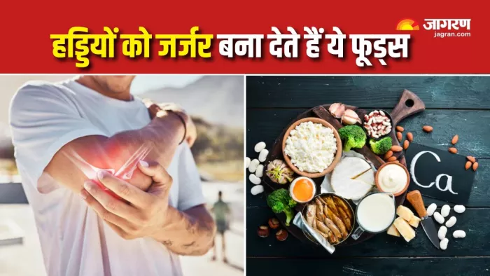 शरीर में कैल्शियम की कमी का कारण बनते हैं ये 5 फूड्स (Picture Courtesy: Freepik)