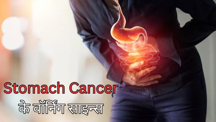 इन शुरुआती लक्षणों से करें पेट के कैंसर की पहचान