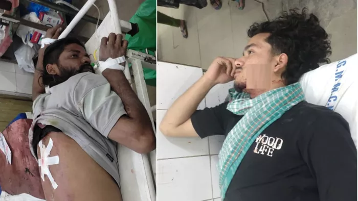 बर्मामाइंस मुस्लिम बस्ती में हुई मारपीट में घायल हुए दो युवक (फोटो- जागरण)
