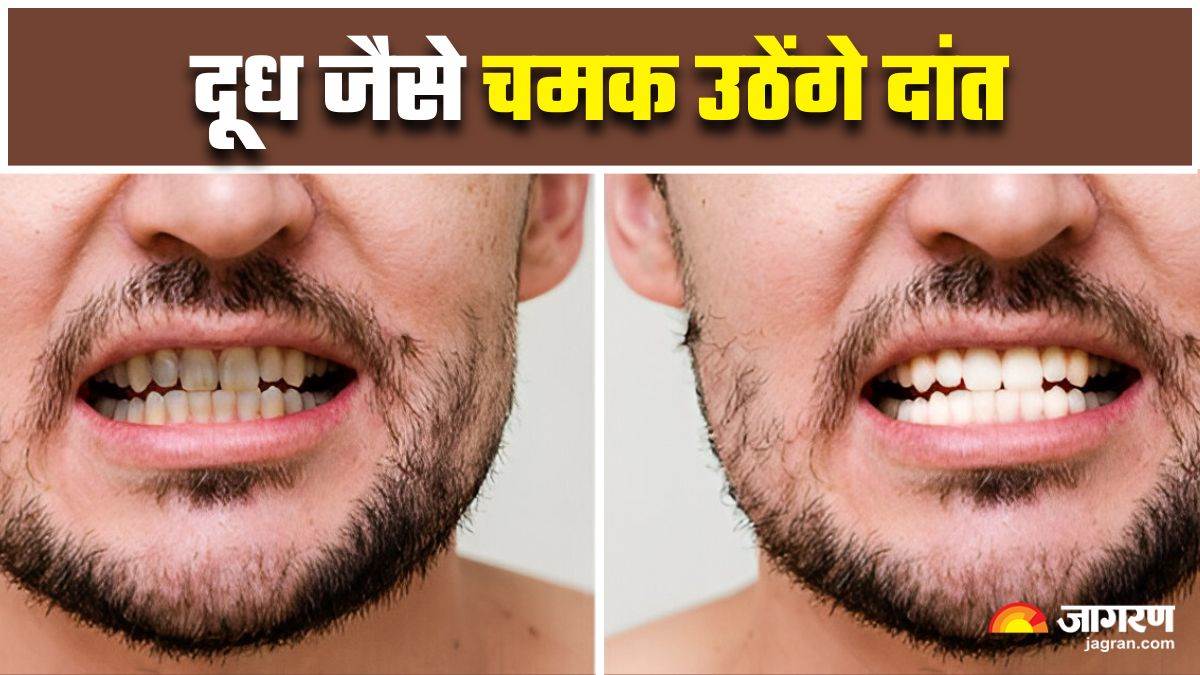 https://www.jagranimages.com/images/newimg/05042025/05_04_2025-naturally_whiten_teeth_23912673.jpg