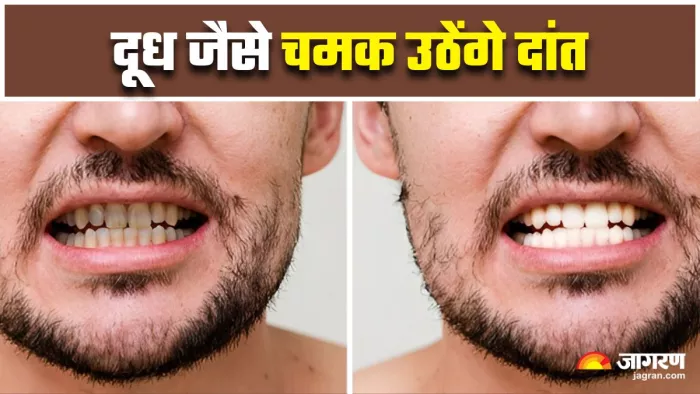 टूथपेस्ट में मिलाएं ये 5 चीजें और फिर करें ब्रेश, लौट आएगी दांतों की खोई चमक (Image Source: Freepik)