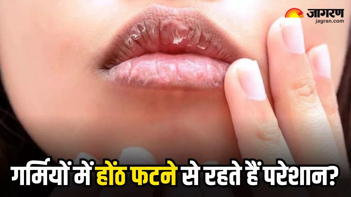 Dry Lips: गर्मियों में भी होंठ फटने से हैं परेशान, तो इन असरदार घरेलू नुस्खों को अपनाकर तुरंत पाएं आराम!