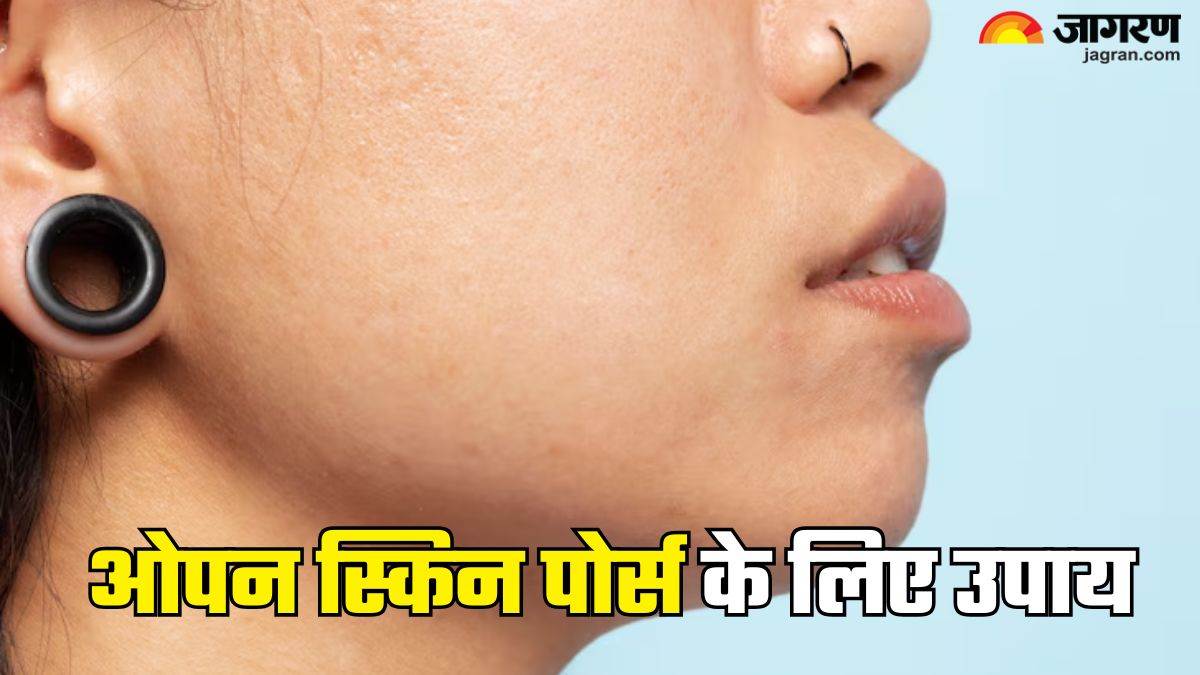 https://www.jagranimages.com/images/newimg/05062025/05_06_2025-open_skin_pores_23956858.jpg
