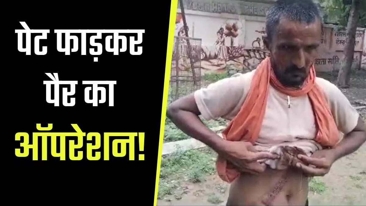 05 07 2023 doctors negligence 23462418 लापरवाही! पैर का इलाज कराने गया था शख्स, डॉक्टर ने कर दिया पेट का ऑपरेशन; यूपी के रायबरेली का मामला