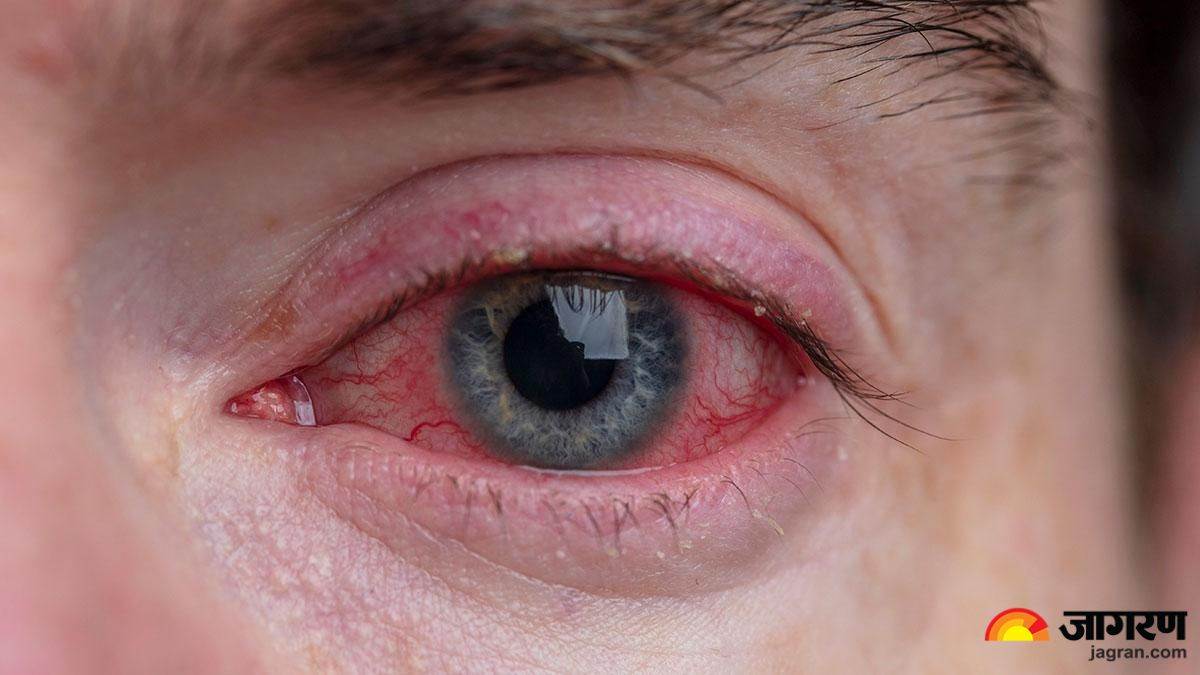 https://www.jagranimages.com/images/newimg/05072024/05_07_2024-monsoon_eye_care_tips_23752950.jpg