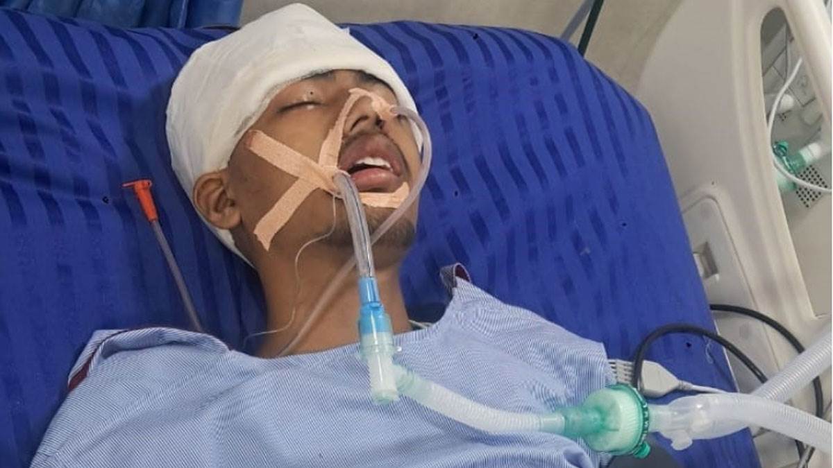 youth injured in bus accident on route to agniveer bharti exam