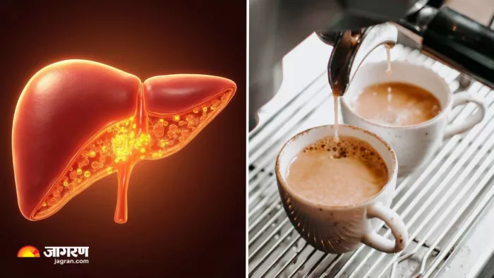 क्या Fatty Liver में कॉफी पीना हो सकता है फायदेमंद? (Image Source: Freepik)