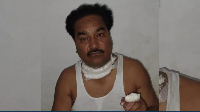 चाइनीज मांझे की चपेट में आकर युवक की गर्दन कटी, घायल