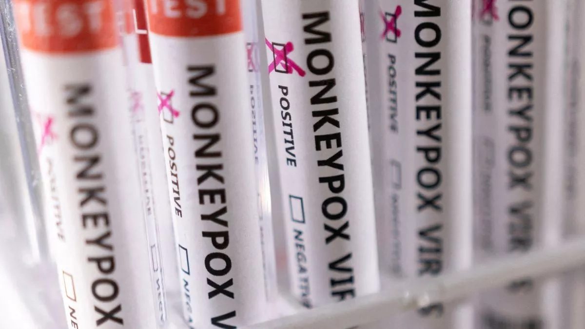 Monkeypox: अमेरिका ने मंकीपाक्स के प्रकोप को सार्वजनिक स्वास्थ्य आपातकाल किया घोषित, 7000 मामले हुए दर्ज