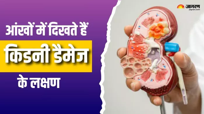 ऐसे करें किडनी डैमेज की पहचान (Picture Courtesy: Freepik)