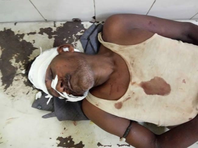 the farmer was beaten up and robbed in broad daylight serious