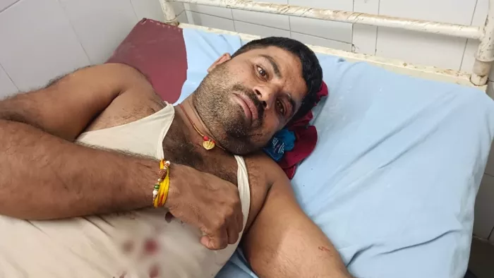 मुगेर: घायल ट्रक चालक मुकेश कुमार। फोटो जागरण