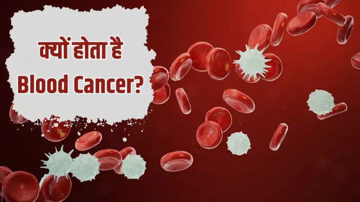 Blood Cancer के लक्षणों की करें पहचान (Image Credit- Freepik)