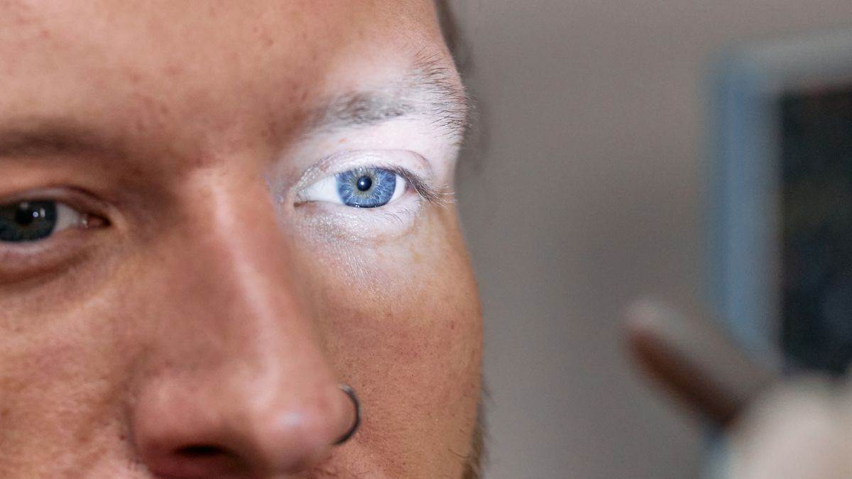 https://www.jagranimages.com/images/newimg/05092025/05_09_2025-cornea_transplant_24036835.jpg