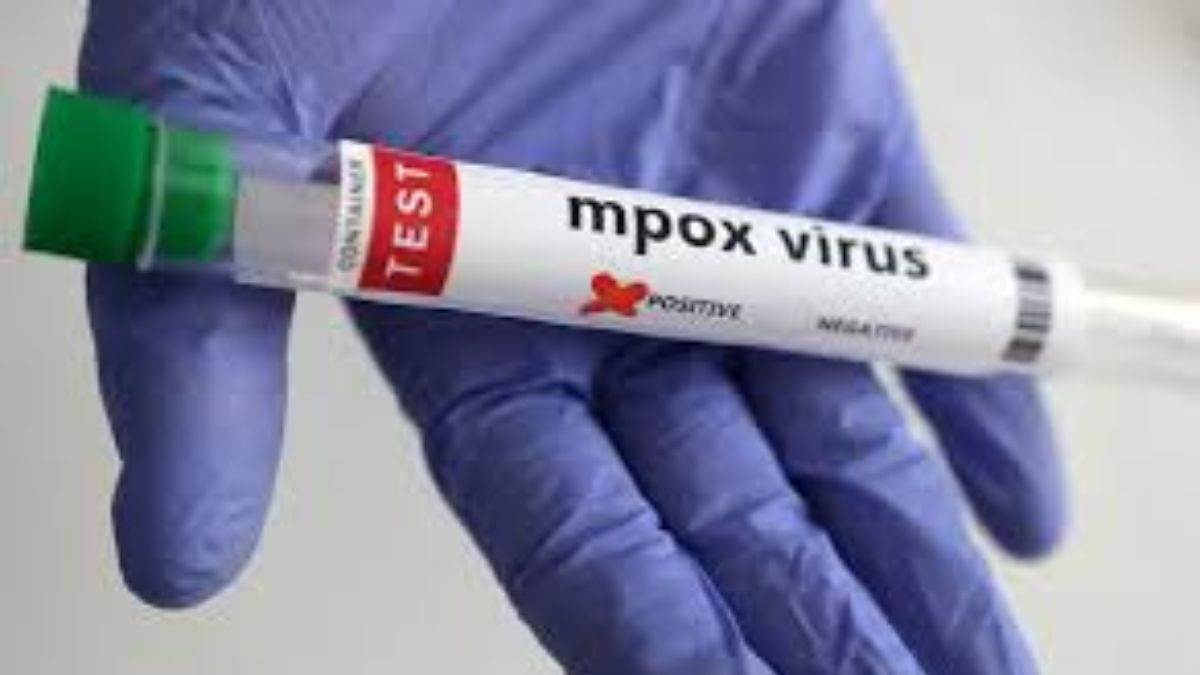 https://www.jagranimages.com/images/newimg/05092025/05_09_2025-mpox_health_emergency_24037098.jpg