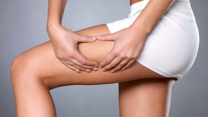 Thigh Rashes Remedies: थाईज़ रैशेज की प्रॉब्लम दूर करने के उपाय