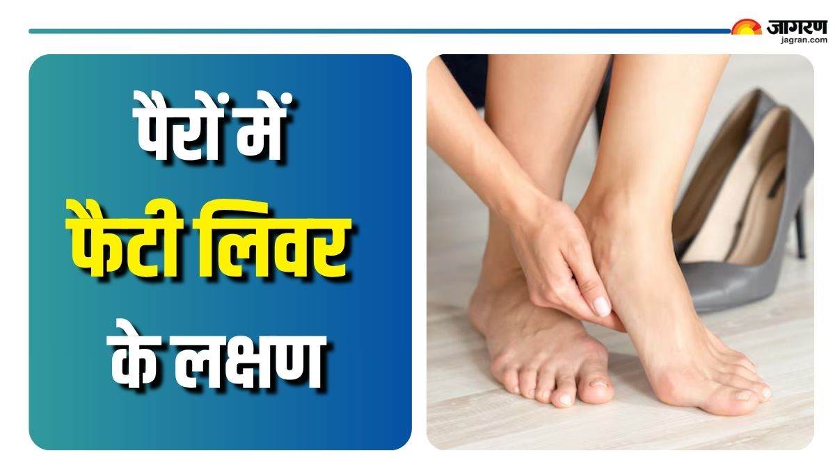 warning sign of fatty liver seen in leg which you should not ignore check details here