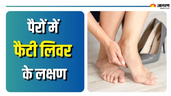 कैसे करें फैटी लिवर की पहचान? (Picture Courtesy: Freepik)