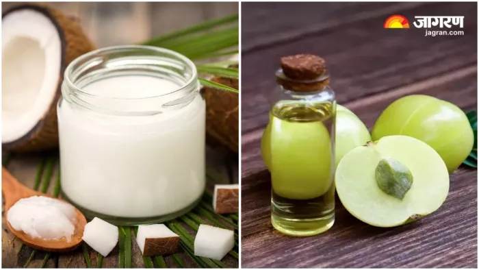 Coconut Oil Vs Amla Oil: हेल्दी और शाइनी हेयर के लिए कौन-सा तेल है ज्यादा फायदेमंद? (Image Source: Freepik)