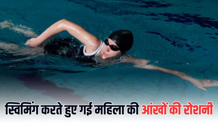 कॉन्टेक्ट लेंस लगाते हैं तो गांठ बांध लें ये बातें (Picture Courtesy: Freepik)