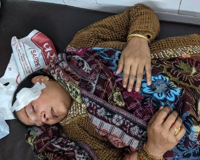 एसडीओ पर जानलेवा हमला, विरोध पर पत्नी को भी मारे पेचकस
