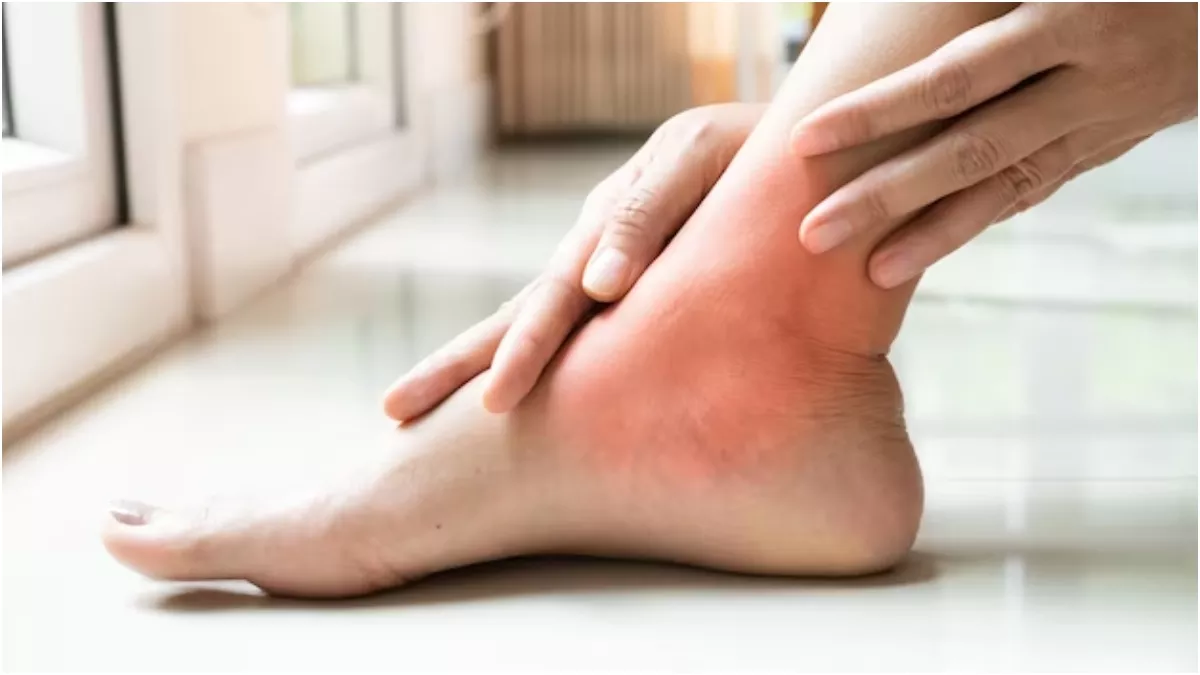 Swollen Feet: पैरों में सूजन होने के यह हो सकते हैं संभावित कारण, ना करें नजरअंदाज