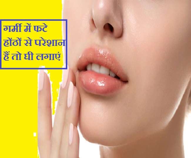 Chapped Lips Care गर्मी में फटे होंठों से परेशान हैं तो इन 5 देसी