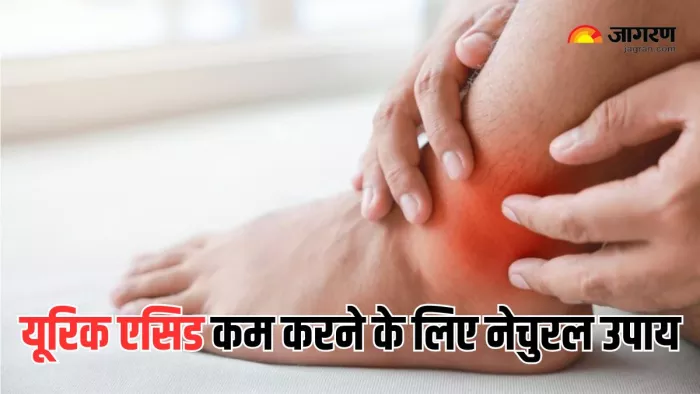 Uric Acid कम करने के लिए आयुर्वेदिक जड़ी-बूटियां (Picture Courtesy: Freepik)