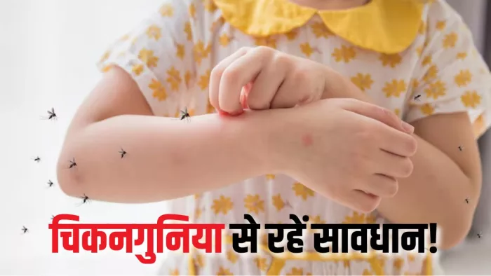 Chikungunya Prevention: चिकनगुनिया से ऐसे करें अपना बचाव (Picture Courtesy: Freepik)